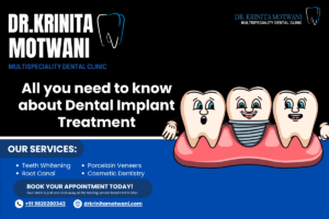 All you need to know about Dental Implant Treatment