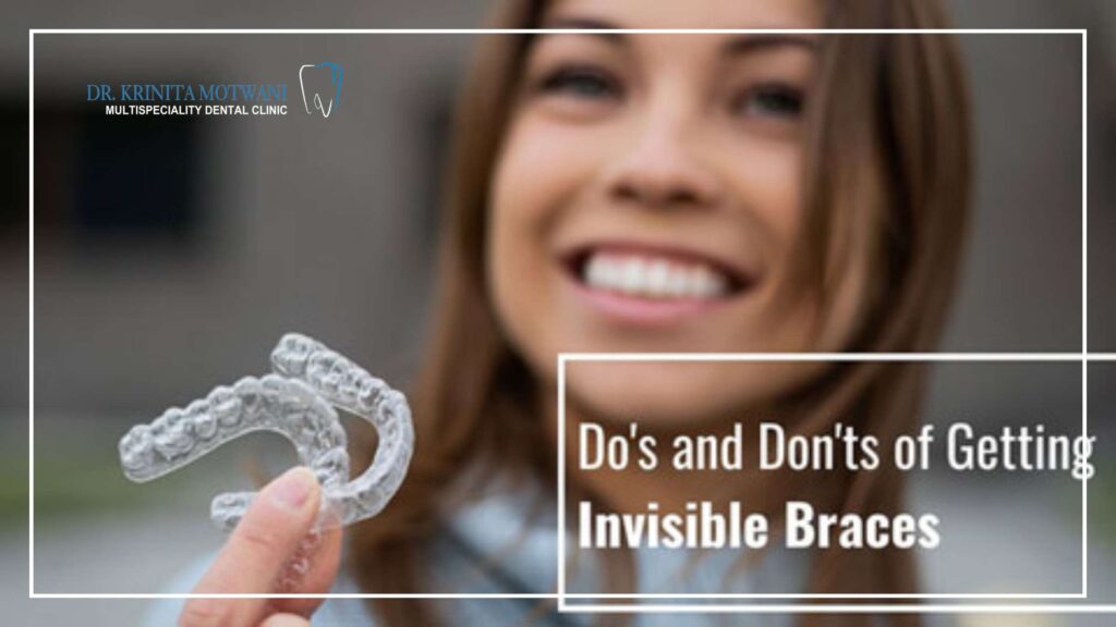 _Do's and Don'ts of Invisible Braces