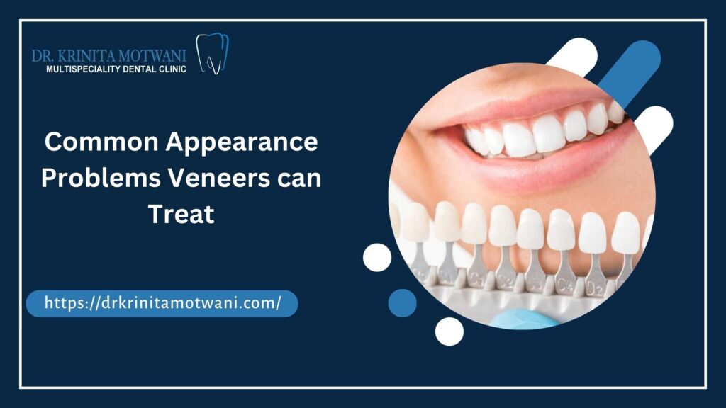 Problems Veneers can Treat