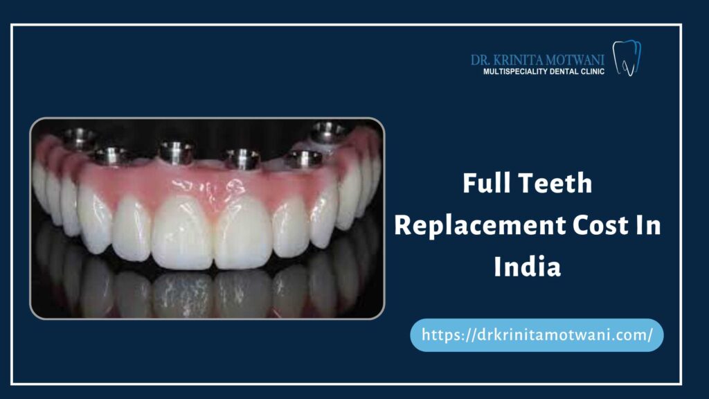 Full Teeth Replacement Cost In India