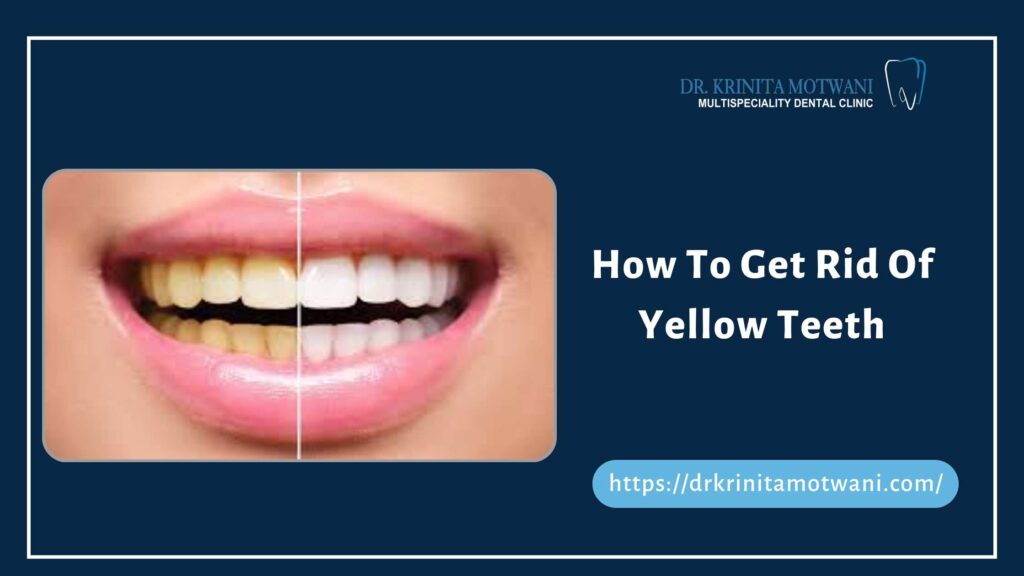 How to get rid of yellow teeth