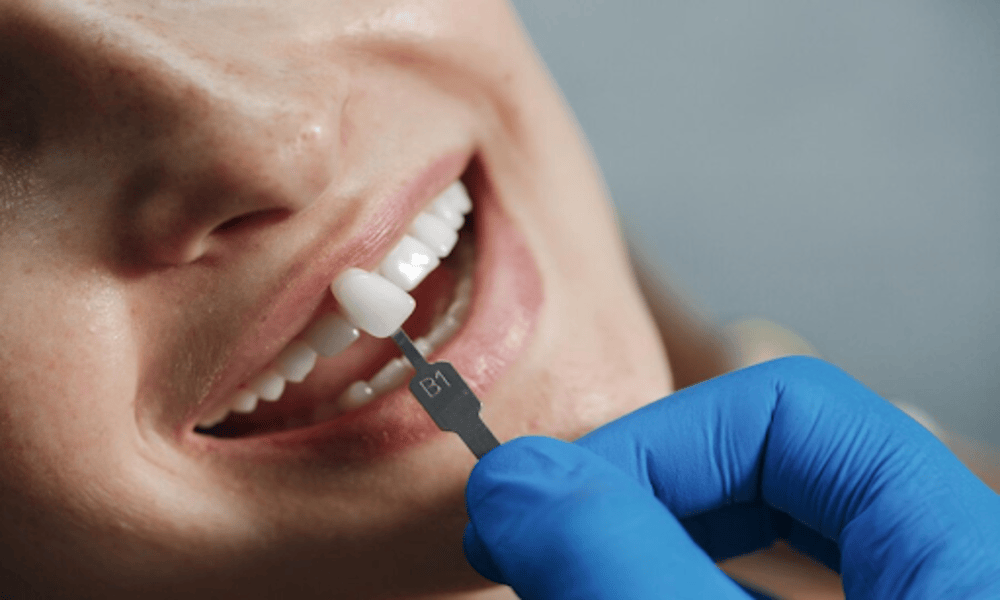 Top Cosmetic Dentistry In Mumbai